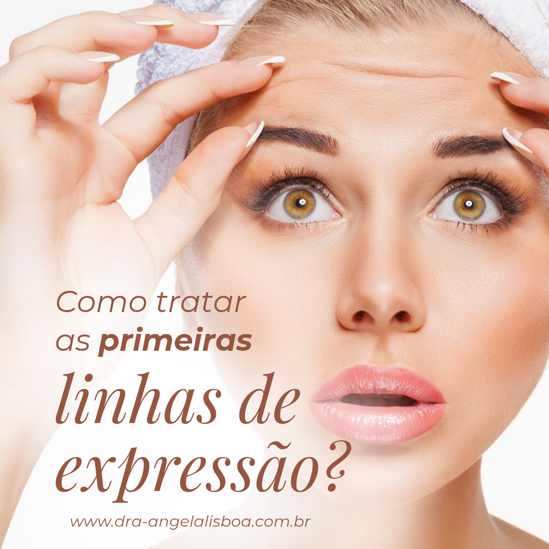 APLICAÇÃO DE TOXINA BOTULÍNICA COM RETORNO! VAMOS RENOVAR ESSA PELE.